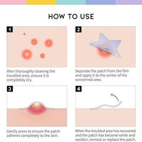 30 Pcs Pimple Patches